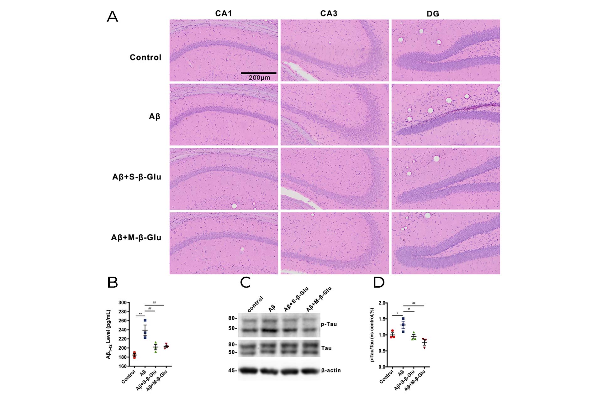 (A)-H&E-staining-of-mouse-hippocampus-and-(B)(C)(D)-Western-blot-analysis-of-tau-and-p-tau-protein-with-significant-differences.jpg